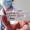 Test rapidi per accertare la guarigione dal Covid-19 in farmacia