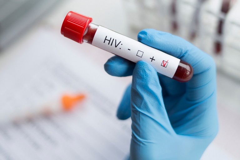 Test Hiv (repertorio)